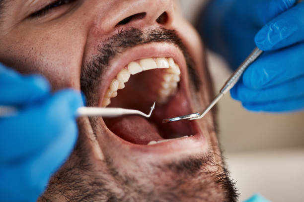 Best Broken or Chipped Tooth Repair in Poydras, LA