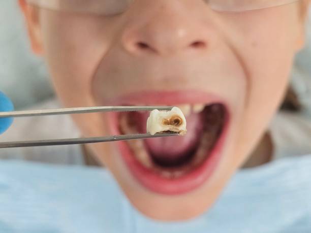 Best Emergency Pediatric Dental Care in Poydras, LA