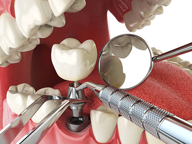  Poydras, LA Emergency Dentist Pros